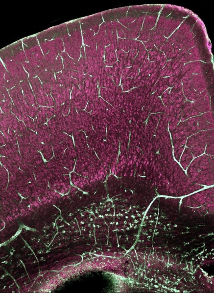 Endocrine Images Art Competition Celebrates Stunning Intersection of Science and Art
