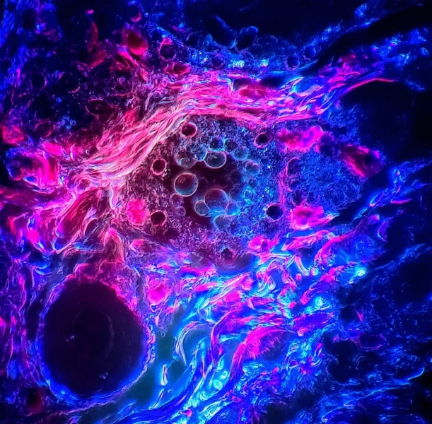 Endocrine Images Art Competition Celebrates Stunning Intersection of Science and Art