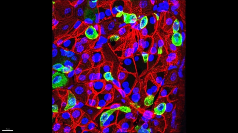 Endocrine Images Art Competition Celebrates Stunning Intersection of Science and Art