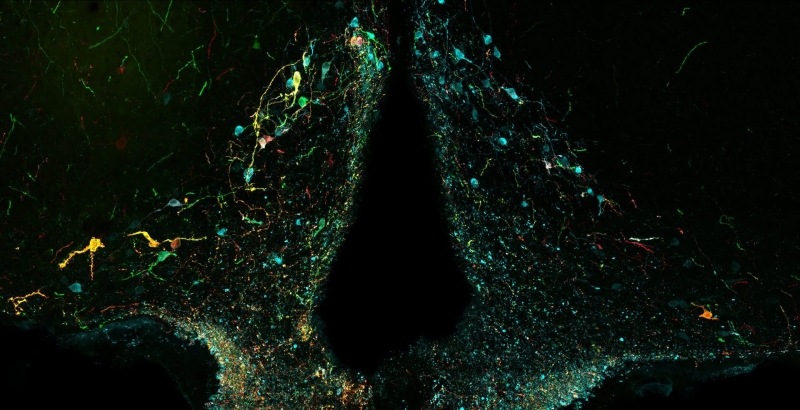 Endocrine Images Art Competition Celebrates Stunning Intersection of Science and Art