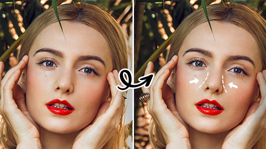 Guide to Plastic Surgery & Cosmetic Treatment Simulation with AI