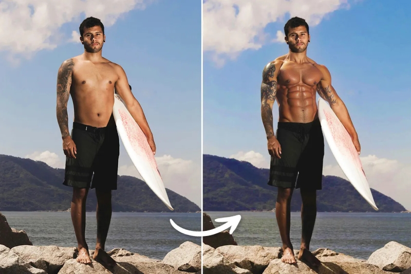 Guide to Plastic Surgery & Cosmetic Treatment Simulation with AI