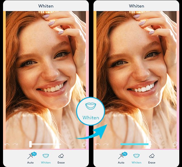 12 Best Teeth Whitening Apps to Enhance Your Perfect Smile in 2024